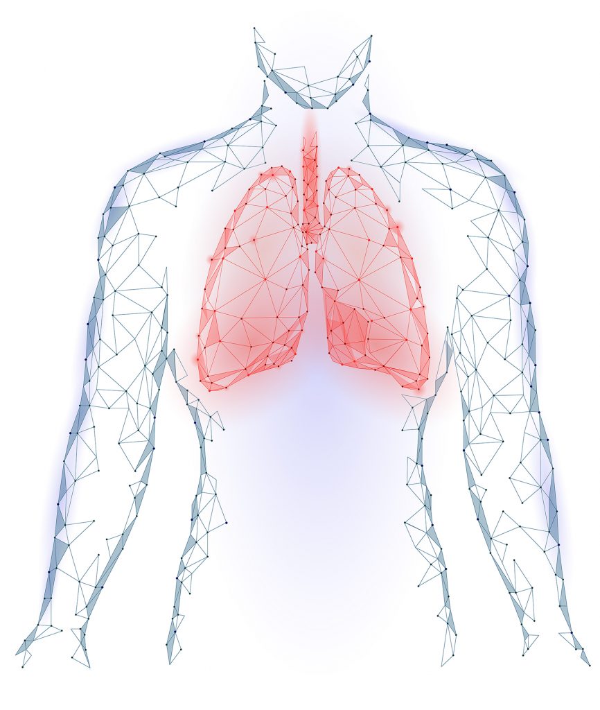 左氧氟沙星可用于偶发分枝杆菌肺部感染的抗菌治疗 Infection Update